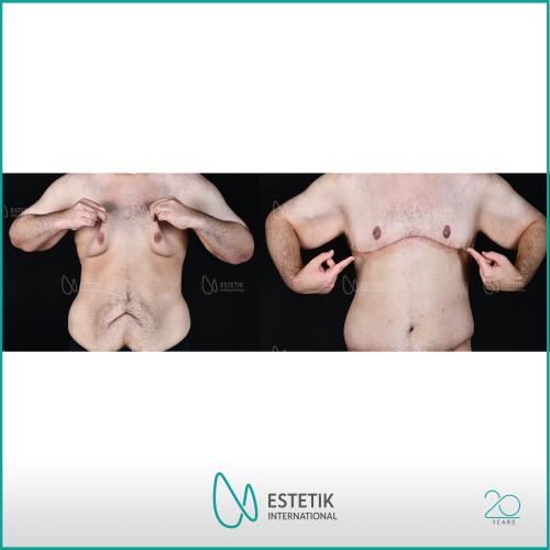 Before after photos of our patients 9